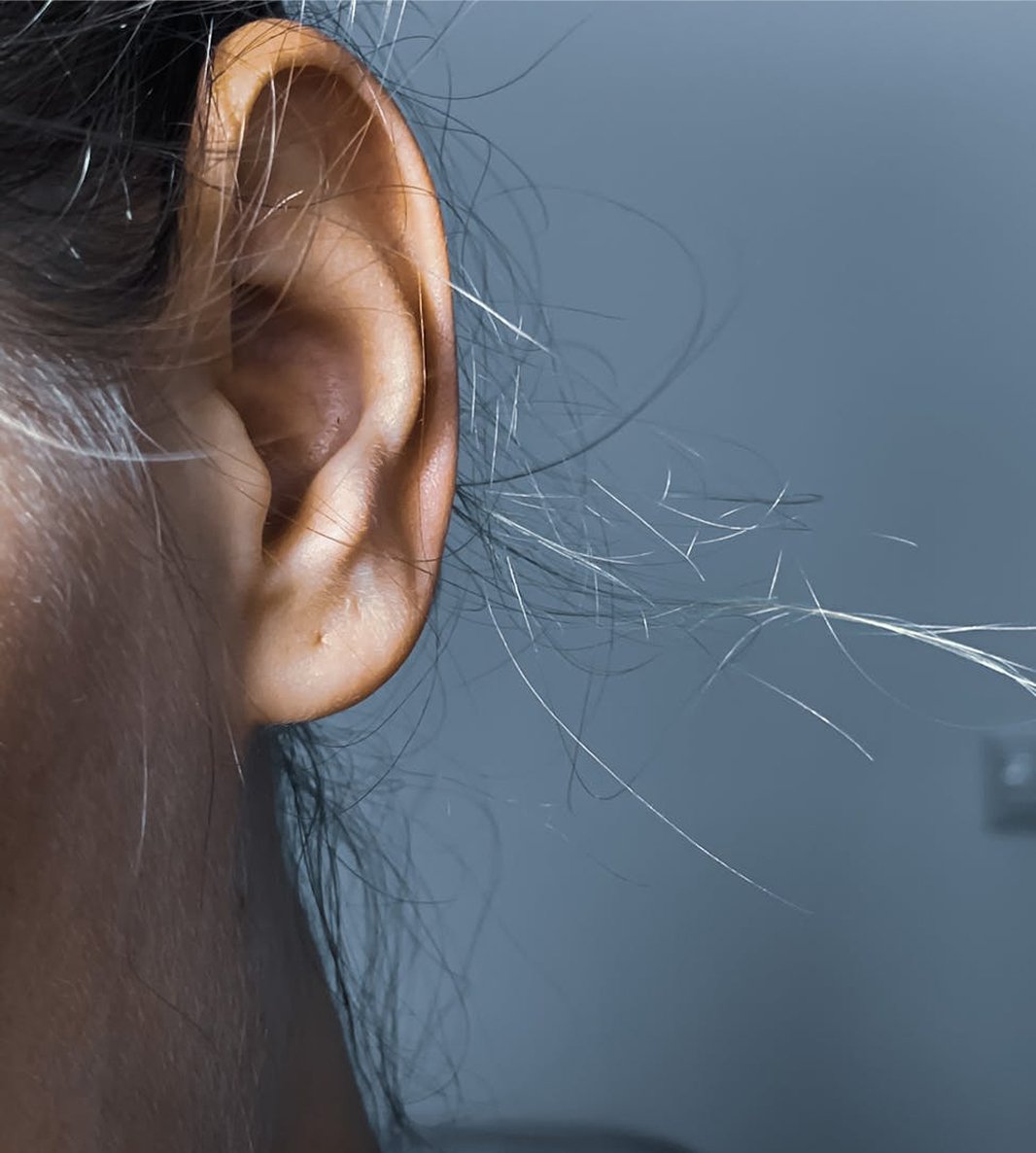 Microsuction Ear Wax Removal